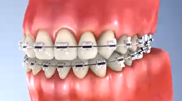 1本1本の歯のバランスを重視